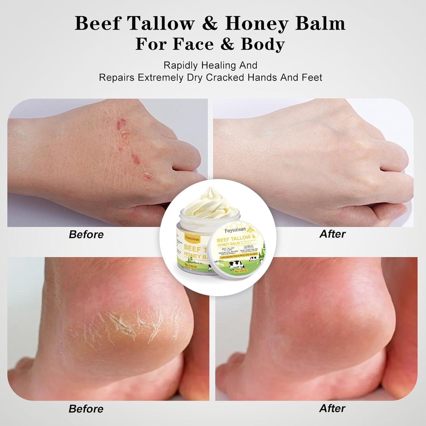 Beef Tallow and Honey Balm for Skin,Tallow Face Moisturizer Cream with Sodium Hyaluronate, Rose Essential Oil,Jojoba Oil,Deep Nourishment